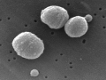 PNEUMOCOQUE