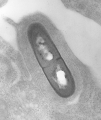 LISTERIA