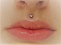 PHILTRUM