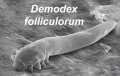DEMODEX