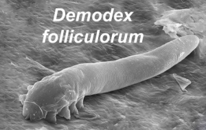 DEMODEX