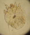 Sarcopte