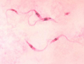 TRYPANOSOME