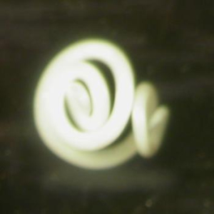 ANISAKIS