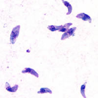 TOXOPLASME