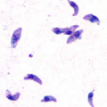 TOXOPLASME