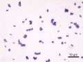 STAPHYLOCOQUE