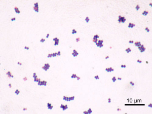 STAPHYLOCOQUE