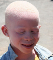 ALBINOS