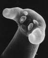 TRICHINE