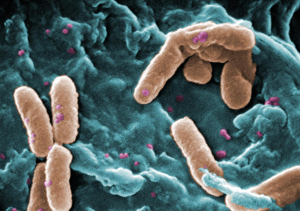 PSEUDOMONAS