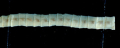 BOTHRIOCÉPHALE